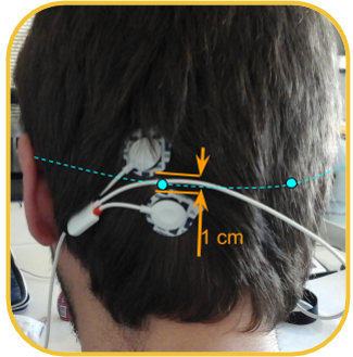 Eeg Electrode Placement